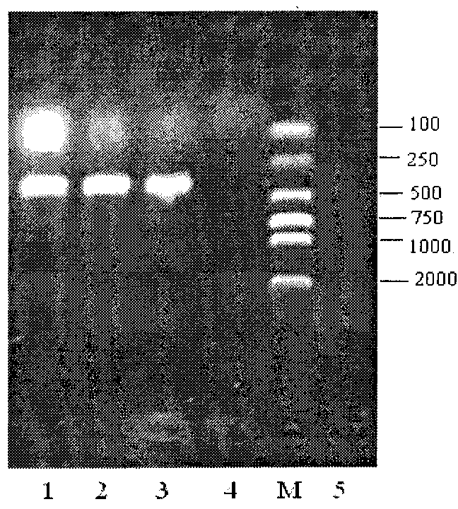 Streptococcus suis 7-type high-density fermentation medium and special strain