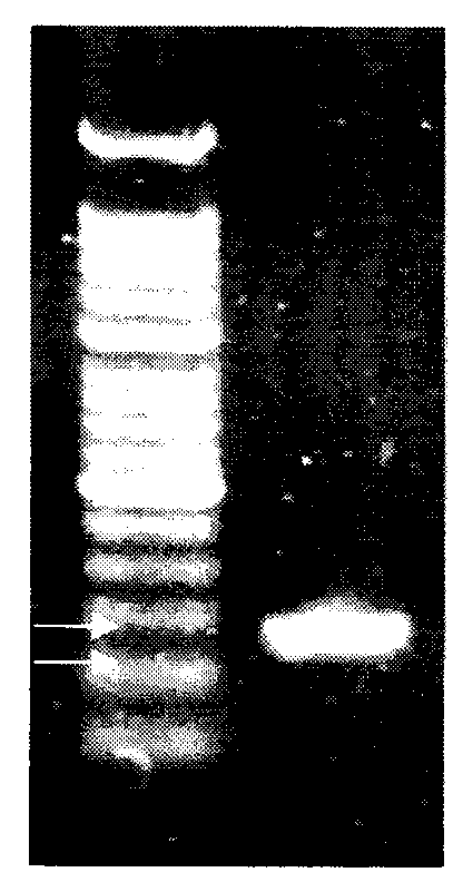 Preparation method for probes related to breast cancer molecular markers and application of same