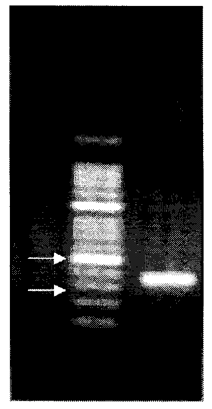 Preparation method for probes related to breast cancer molecular markers and application of same