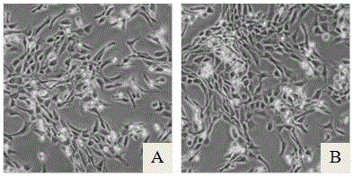 Serum-free cartilage cell culture solution