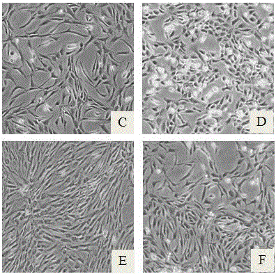 Serum-free cartilage cell culture solution