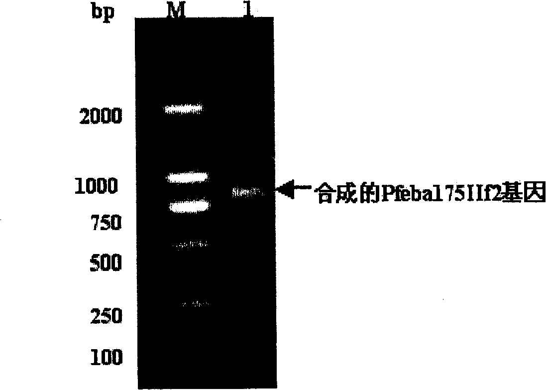 Recombinant Plasmodium falciparum 175kD erythrocyte conjugated antigen functional region protein and its preparation and use