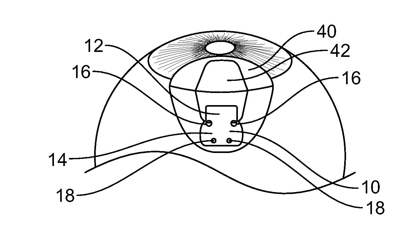 Fiber matrix for maintaining space in soft tissues