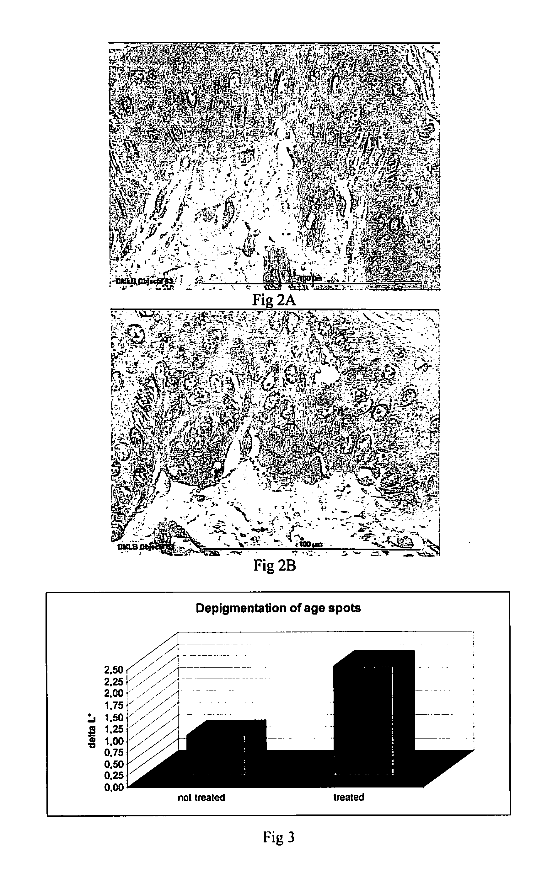 Composition and Uses Thereof