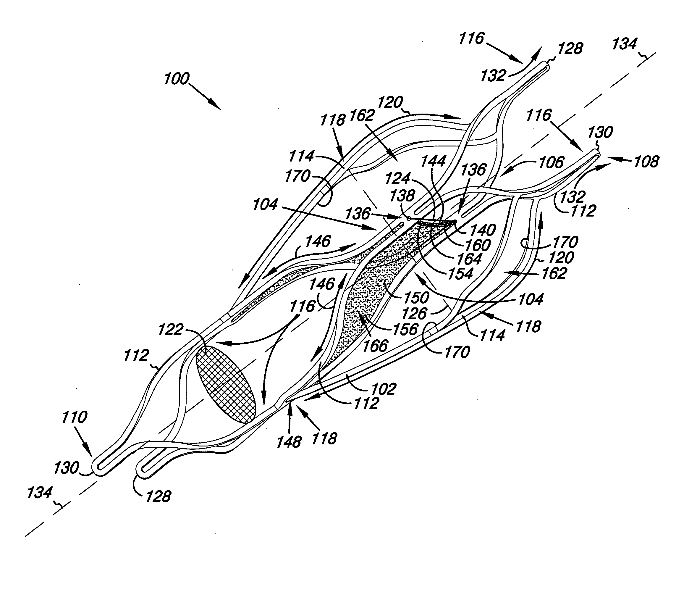 Venous valve, system, and method with sinus pocket