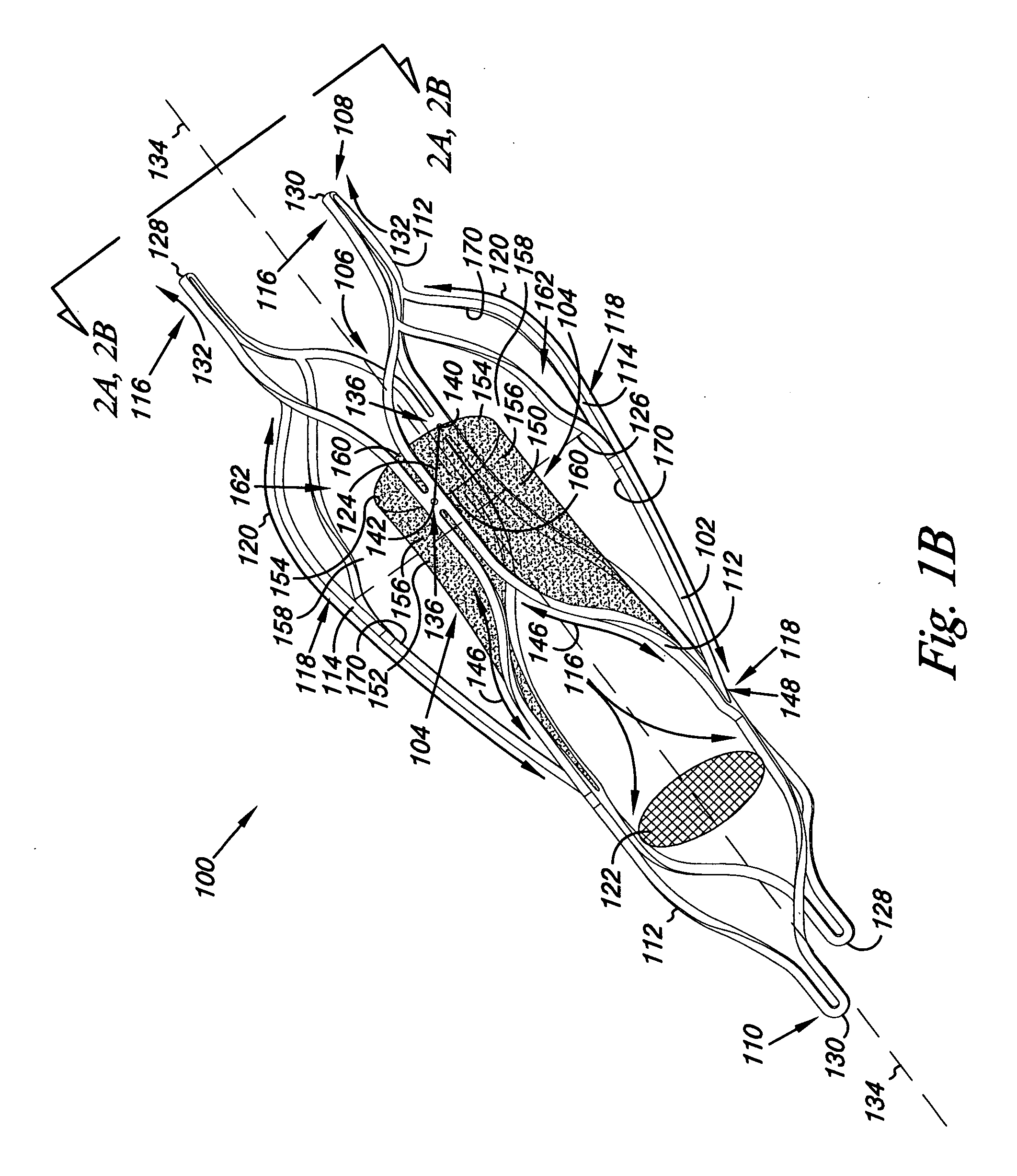 Venous valve, system, and method with sinus pocket