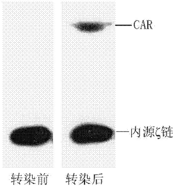 Human VEGFR-1 (Vascular Endothelial Growth Factor Receptor-1) targeting genetically engineered lymphocyte as well as preparation method and application thereof