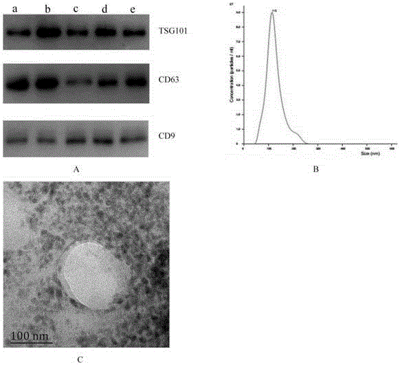 Method and reagent of extracting exosome from urine