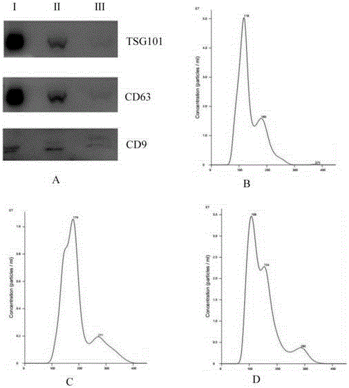 Method and reagent of extracting exosome from urine