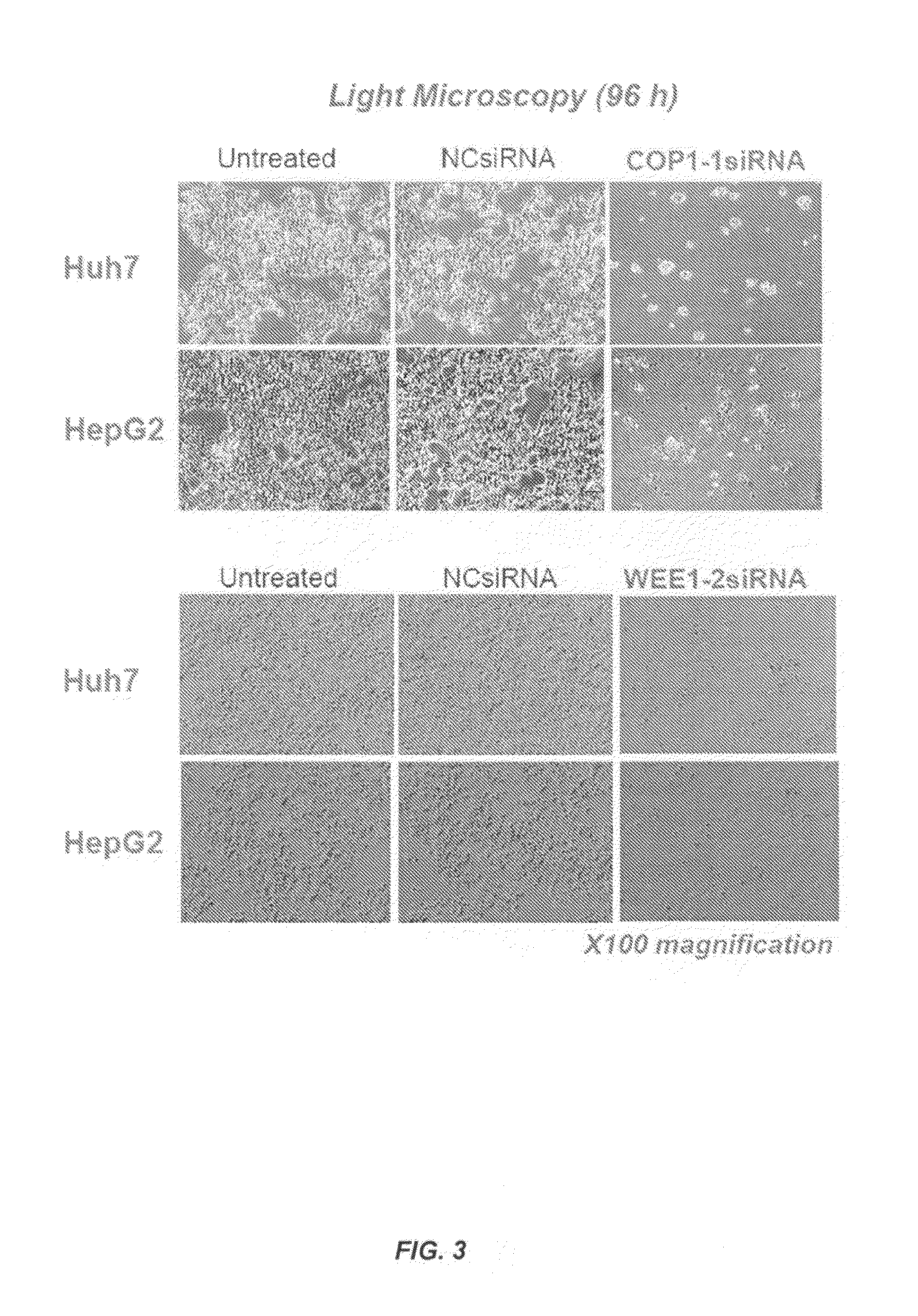 Compositions and methods for silencing genes expressed in cancer