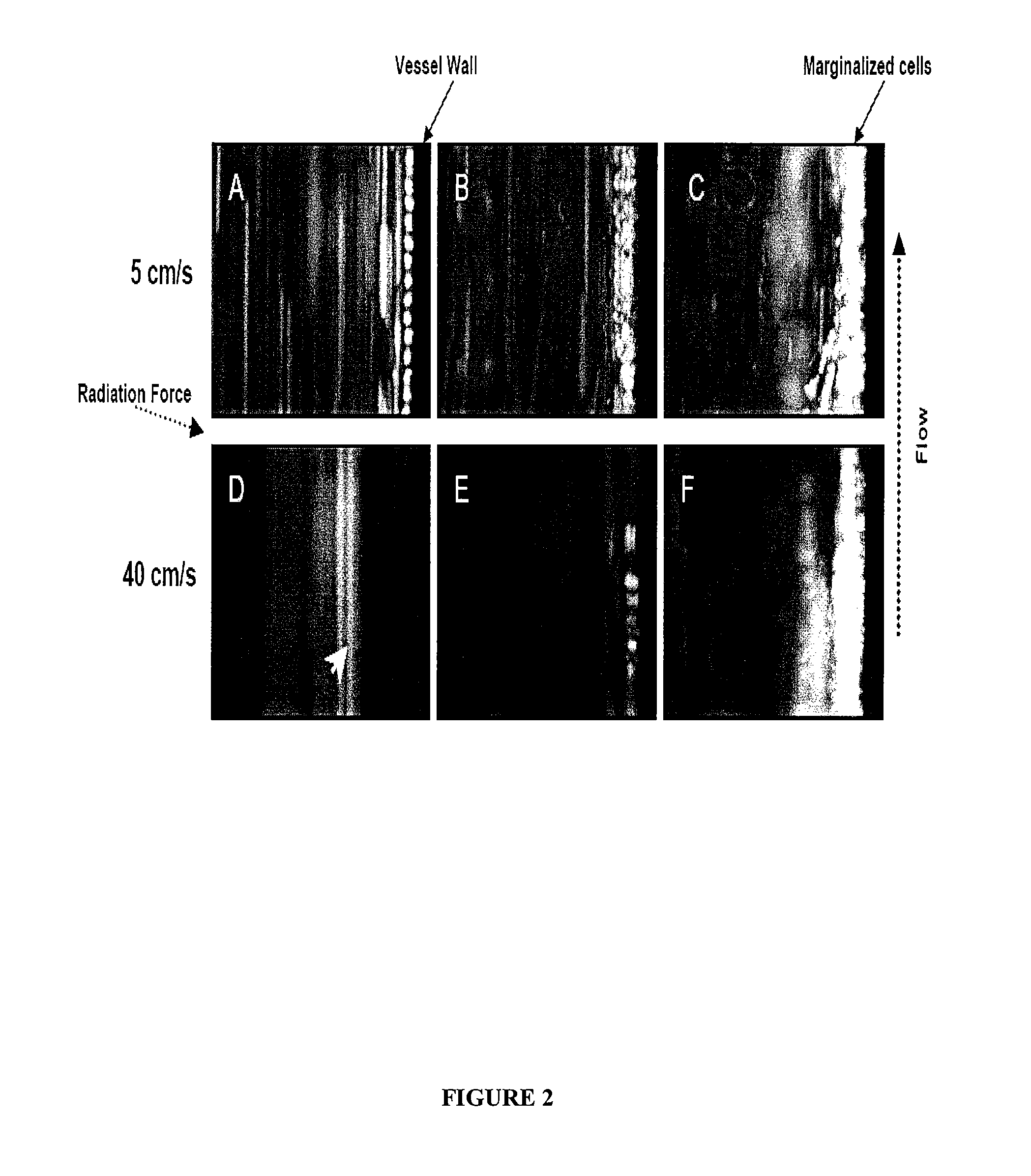 Directed cell-based therapy using microbubble tagged cells