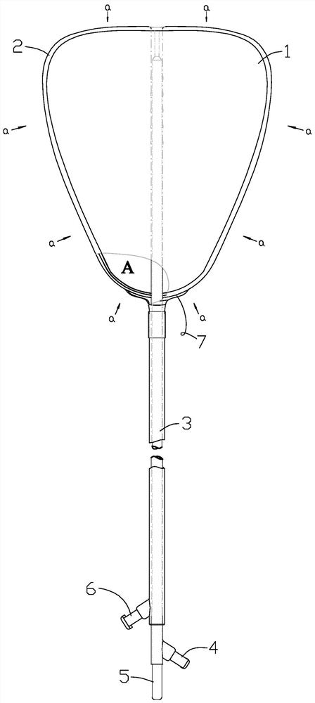 Anti-adhesion uterine stent