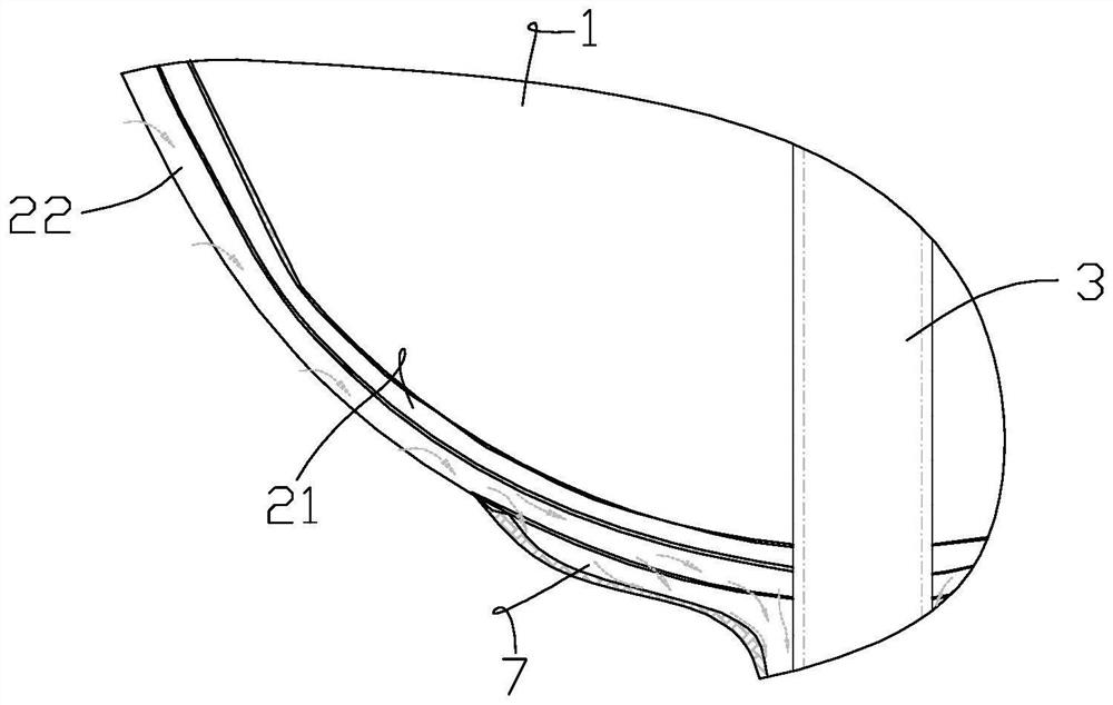 Anti-adhesion uterine stent