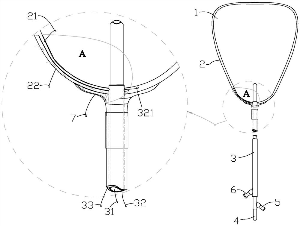 Anti-adhesion uterine stent