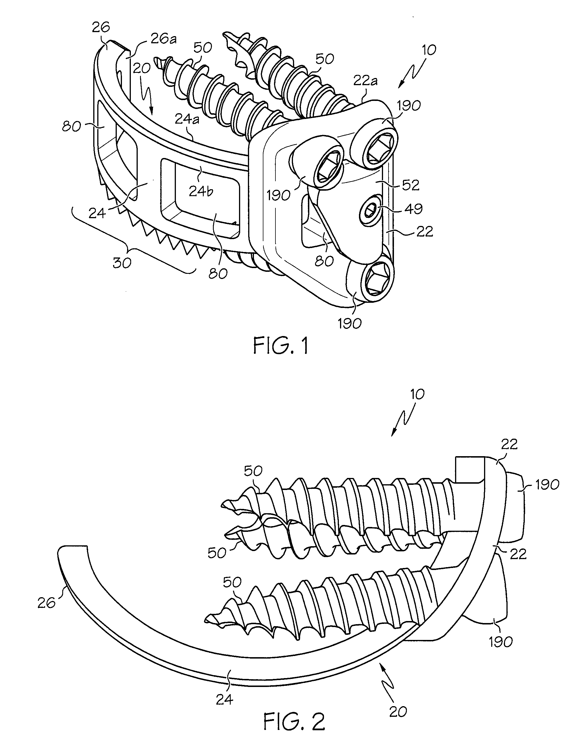 Lateral mount implant device