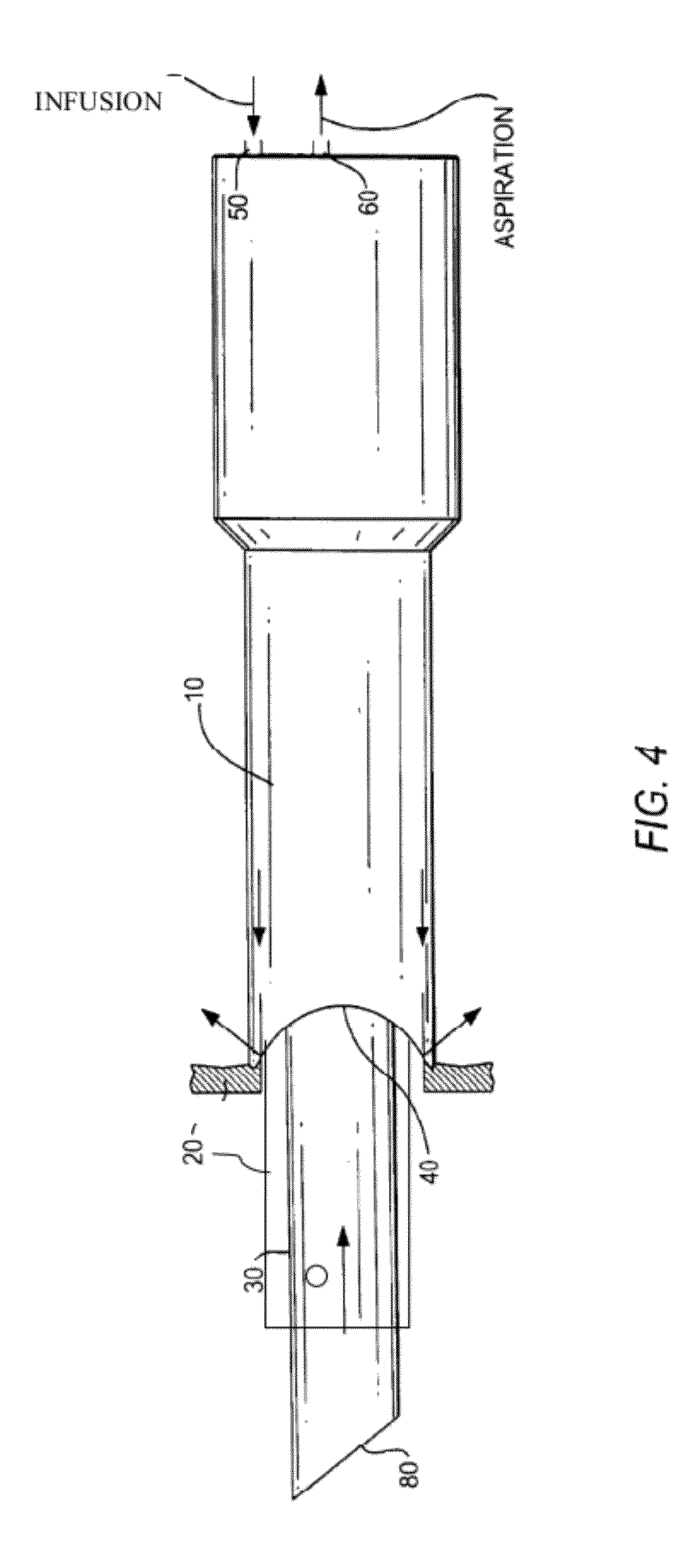 Multi-sleeved surgical ultrasonic vibrating tool suited for phacoemulsification in a manner that prevents thermal injury to ocular tissue