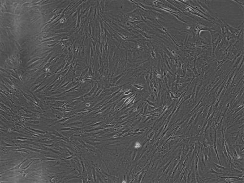 Mouse skeletal muscle satellite cell separation and culture method