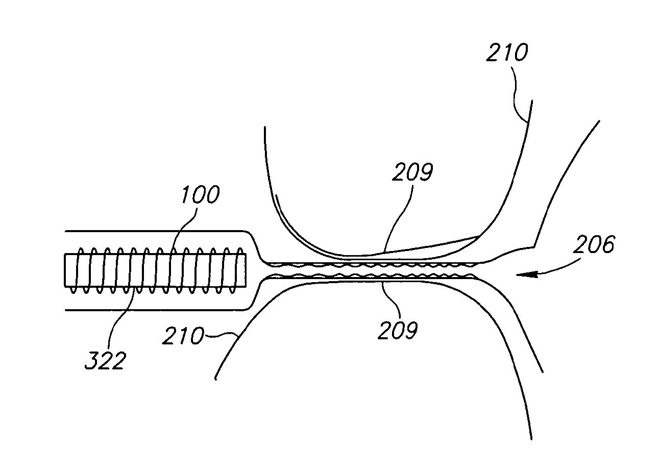 Prostate Treatment Stent