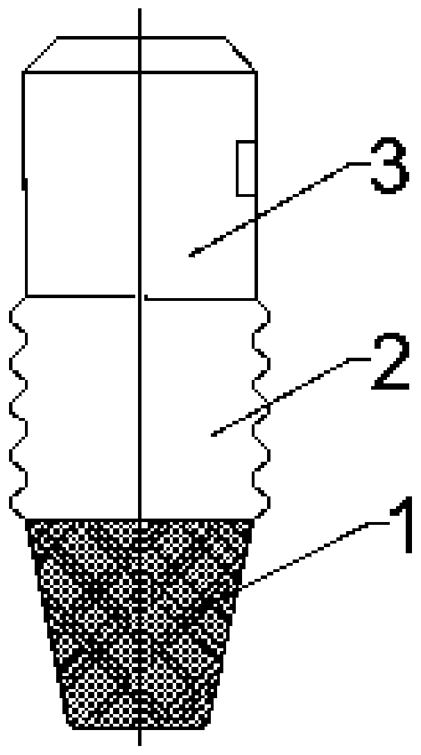 Dental implant