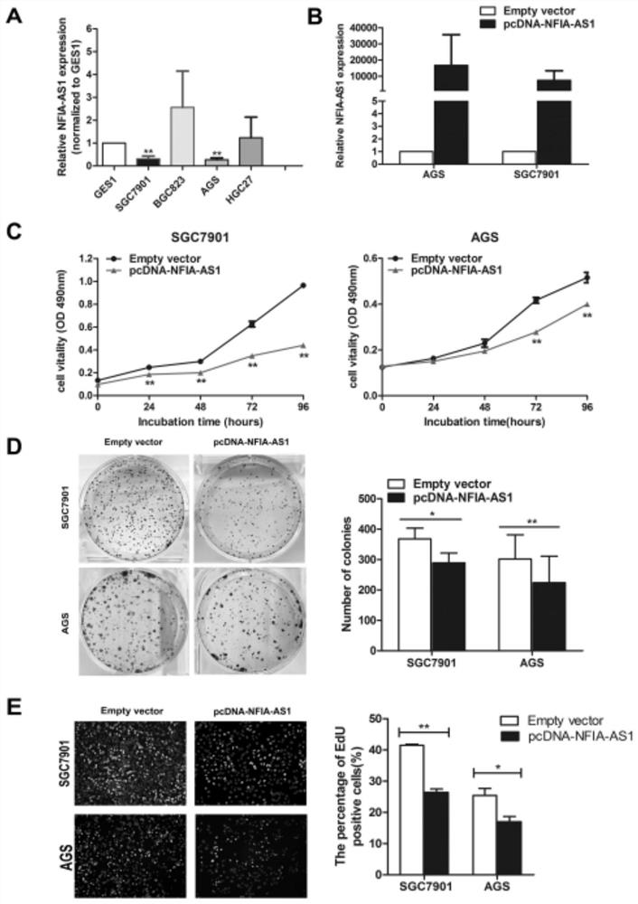 Application of a long non-coding RNA and its composition in the diagnosis/treatment of gastric cancer