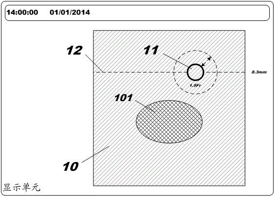 Ultrasonic device display device and related method