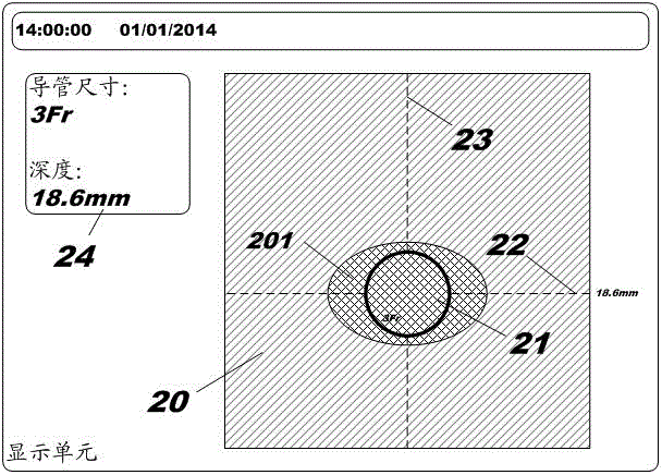 Ultrasonic device display device and related method