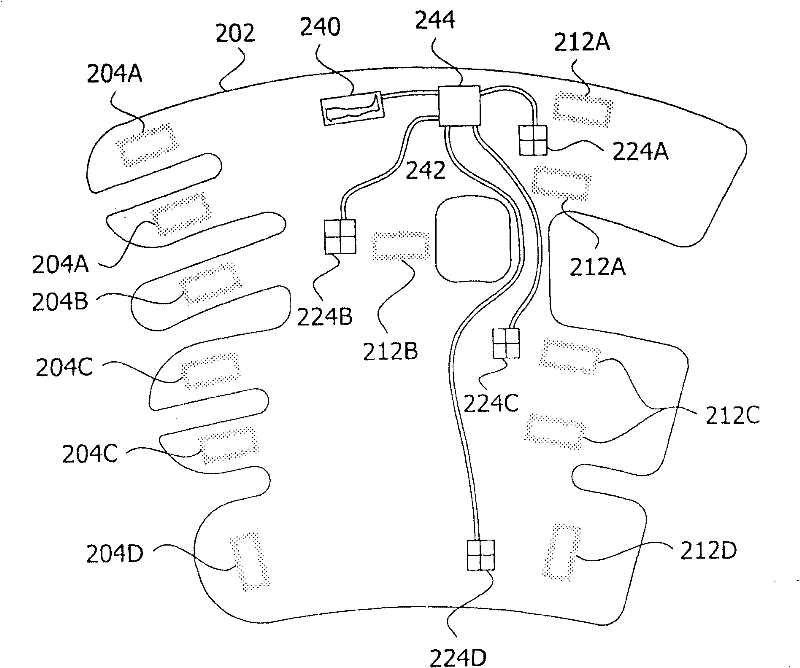 Fitting of compression garment