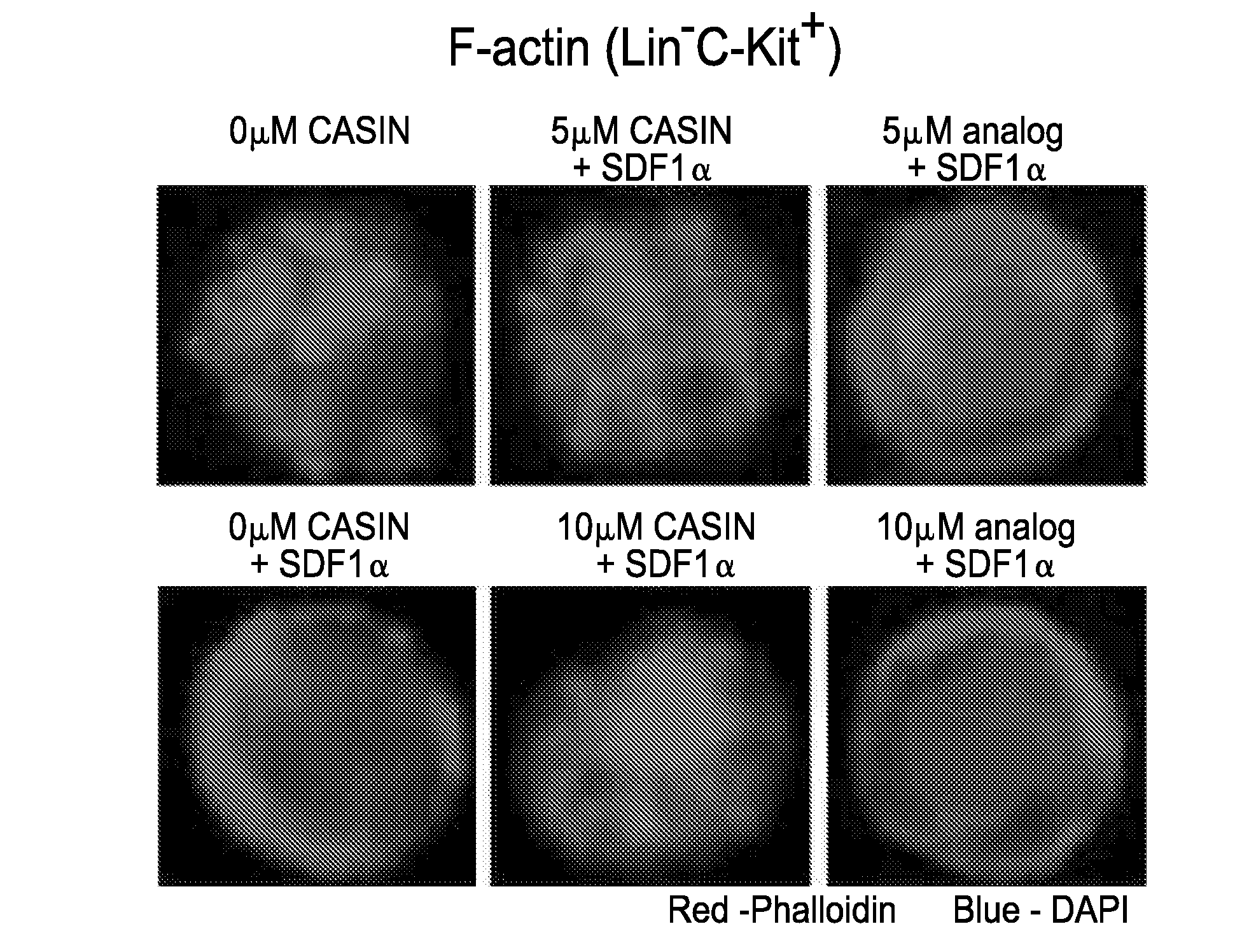 Mobilization of hematopoietic stem cells