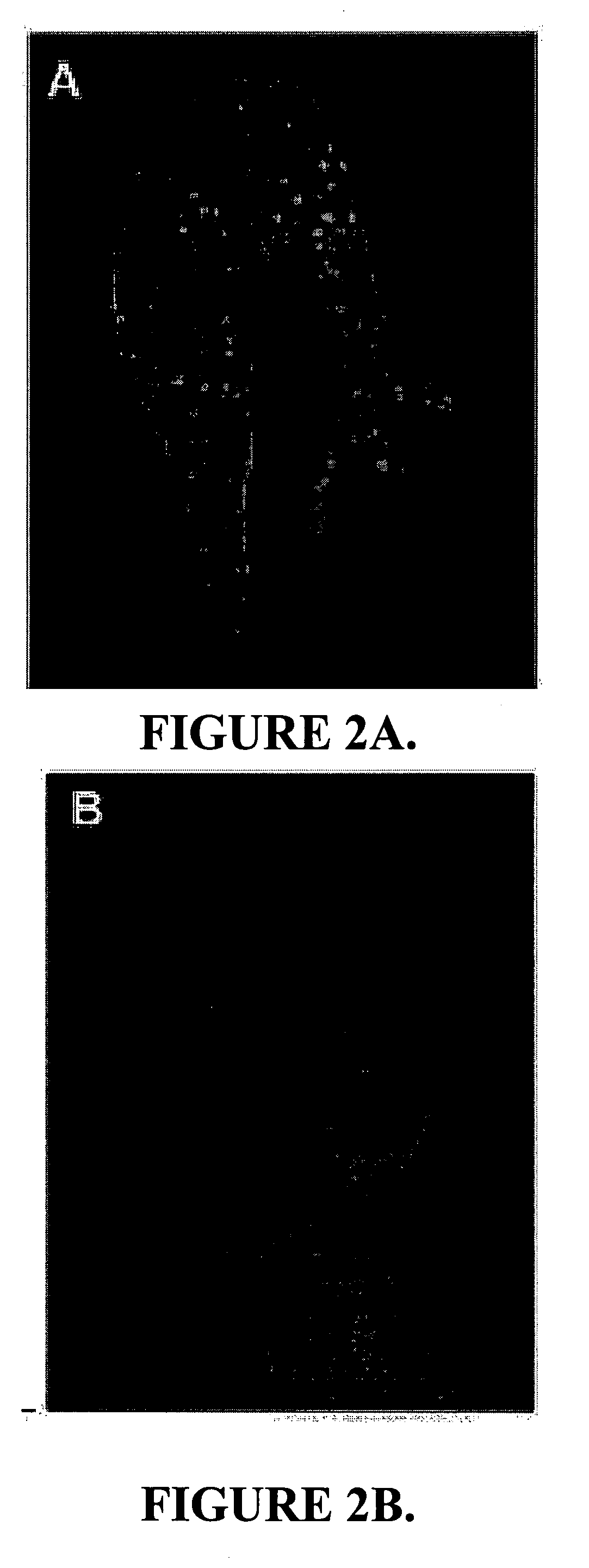 Fluorescent chlorotoxin conjugate and method for intra-operative visualization of cancer