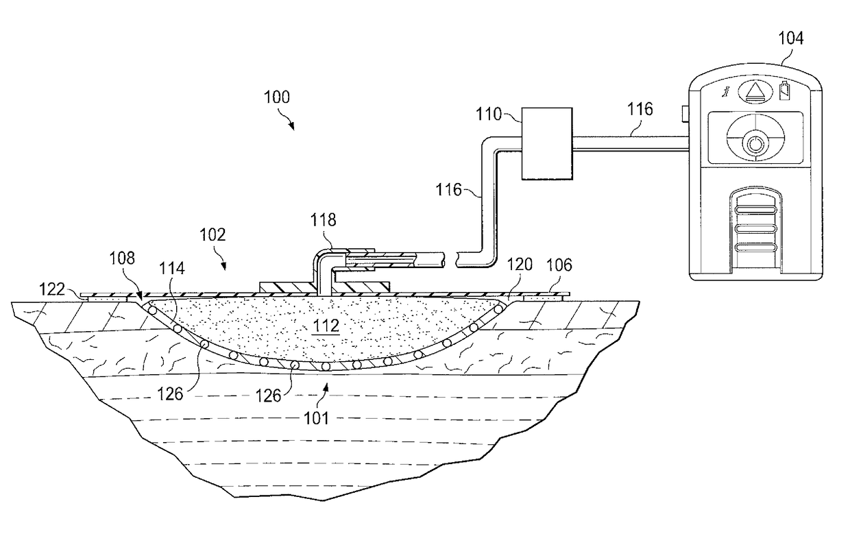 Protease modulating wound interface layer for use with negative pressure wound therapy