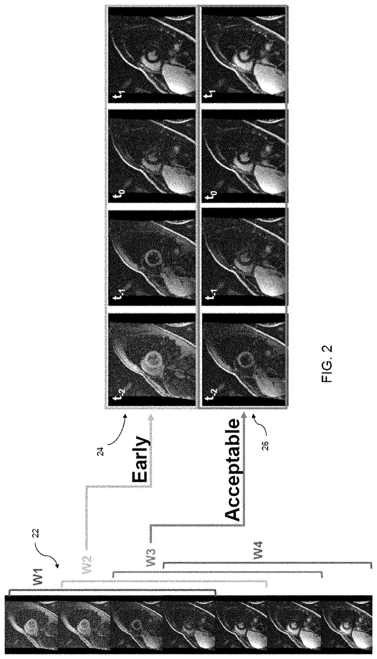 Automated selection of an optimal image from a series of images