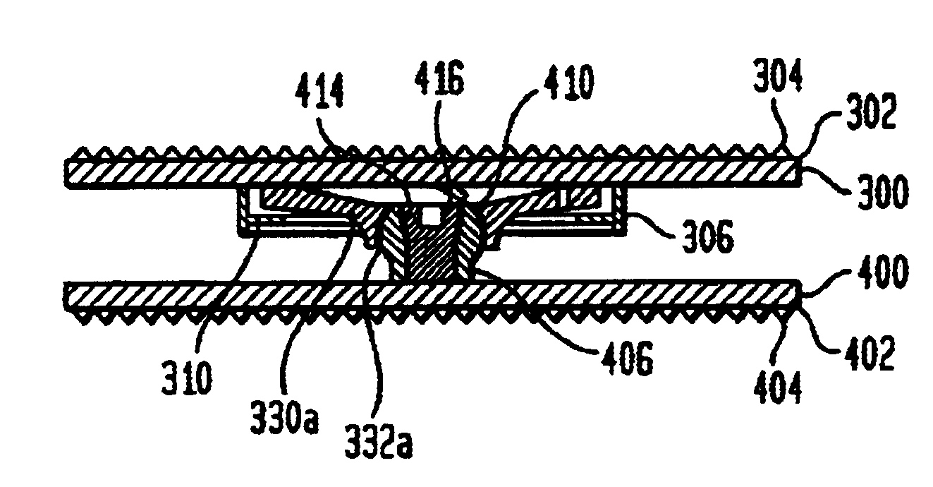 Artificial intervertebral disc having a slotted belleville washer force restoring element