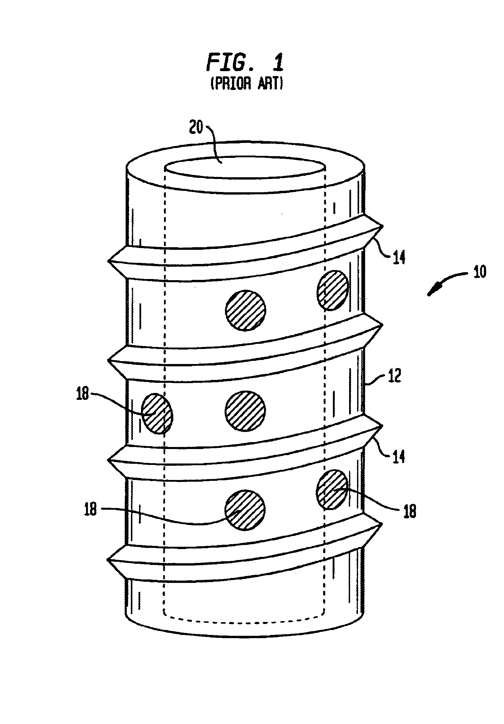 Artificial intervertebral disc having a slotted belleville washer force restoring element