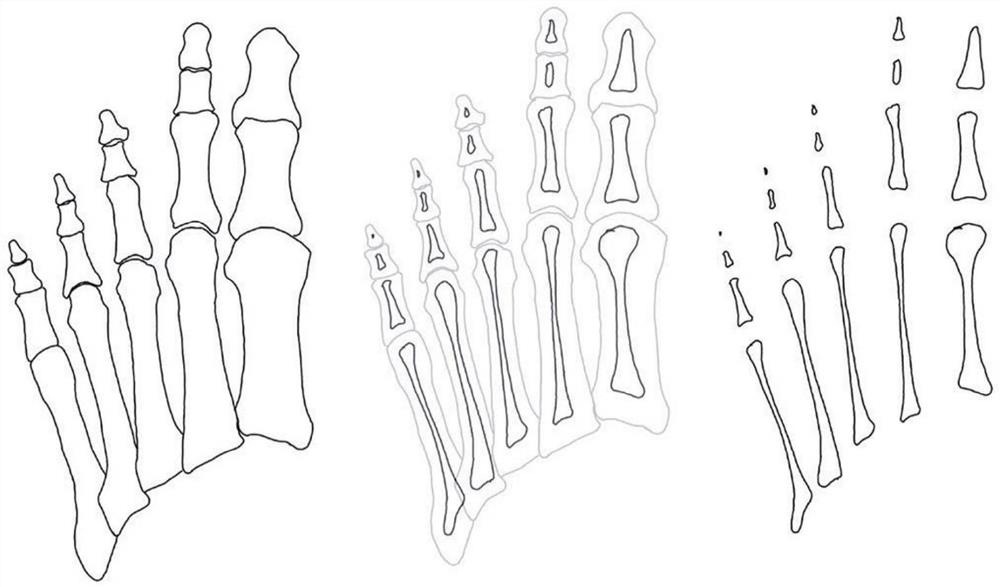 Preparation method of artificial metatarsophalangeal joint prosthesis