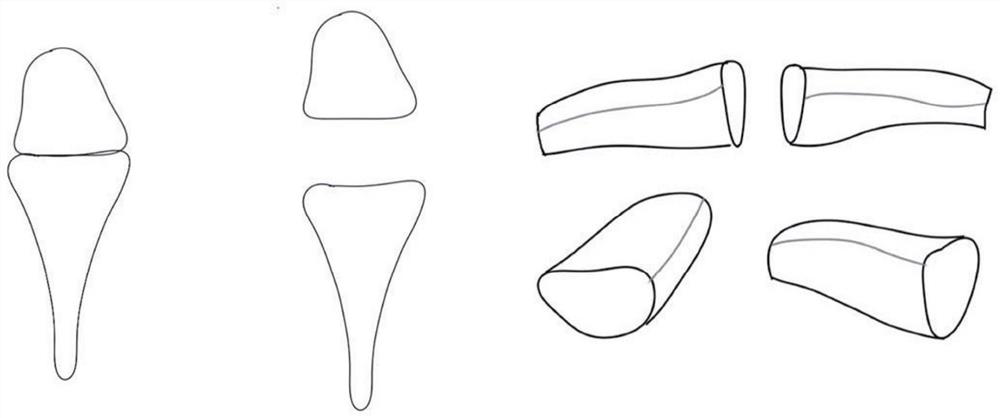 Preparation method of artificial metatarsophalangeal joint prosthesis