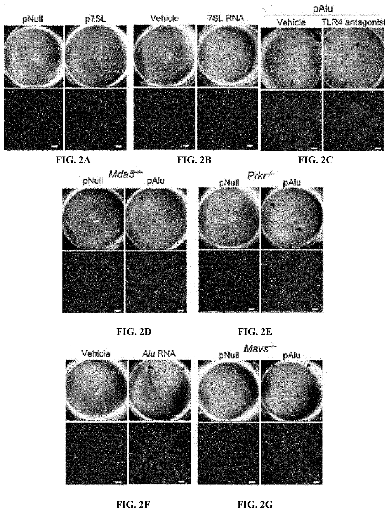 Protection of Cells from Degeneration and Treatment of Geographic Atrophy