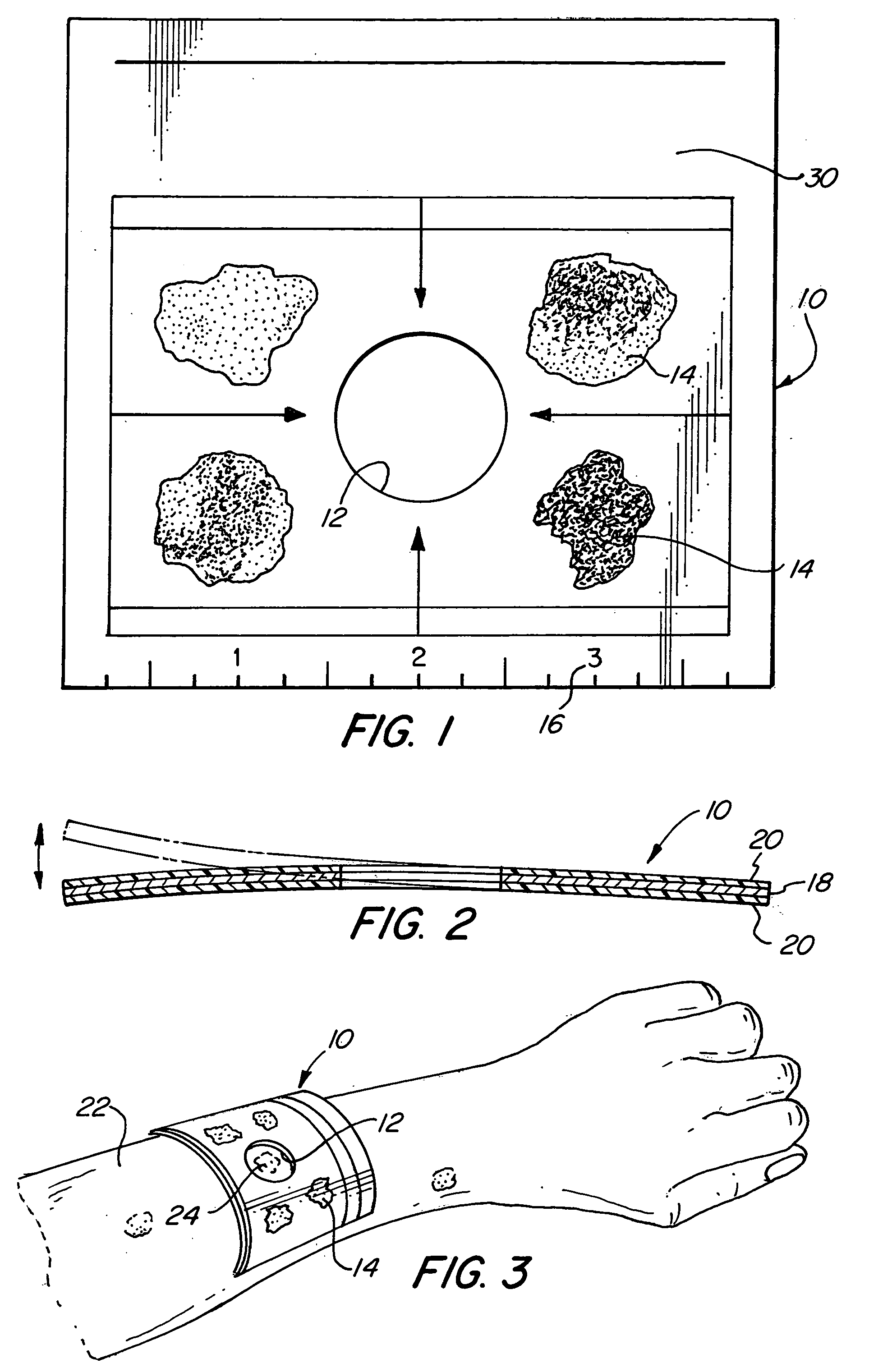 Skin cancer identification template