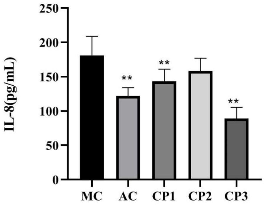 Preparation method and application of anti-inflammatory and kidney-protecting clam peptide