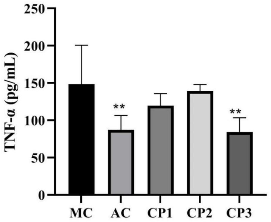 Preparation method and application of anti-inflammatory and kidney-protecting clam peptide