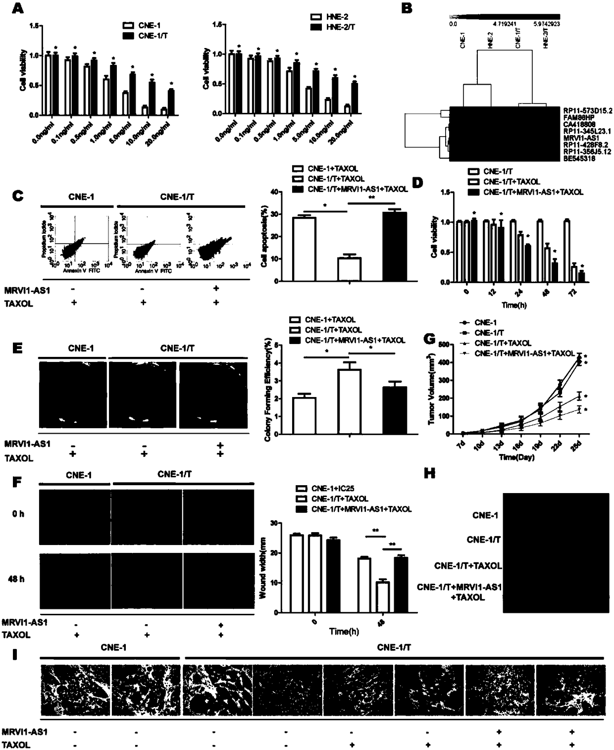 Application of ATF3 as target site in preparing taxol chemosensitization medicine for treating nasopharynx cancer