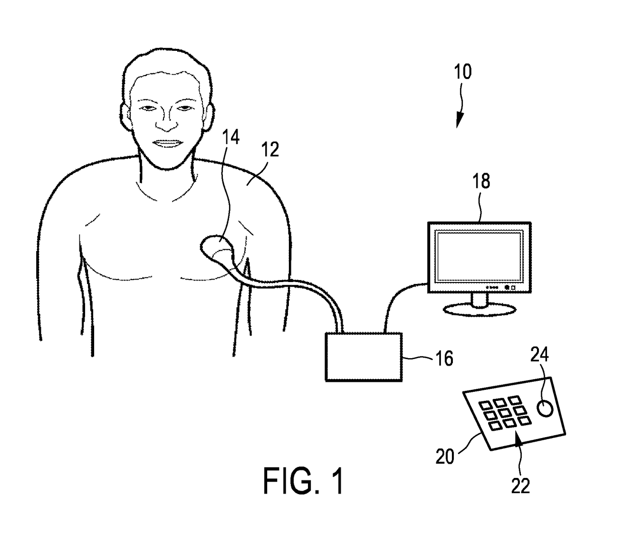 Coupled segmentation in 3D conventional ultrasound and contrast-enhanced ultrasound images