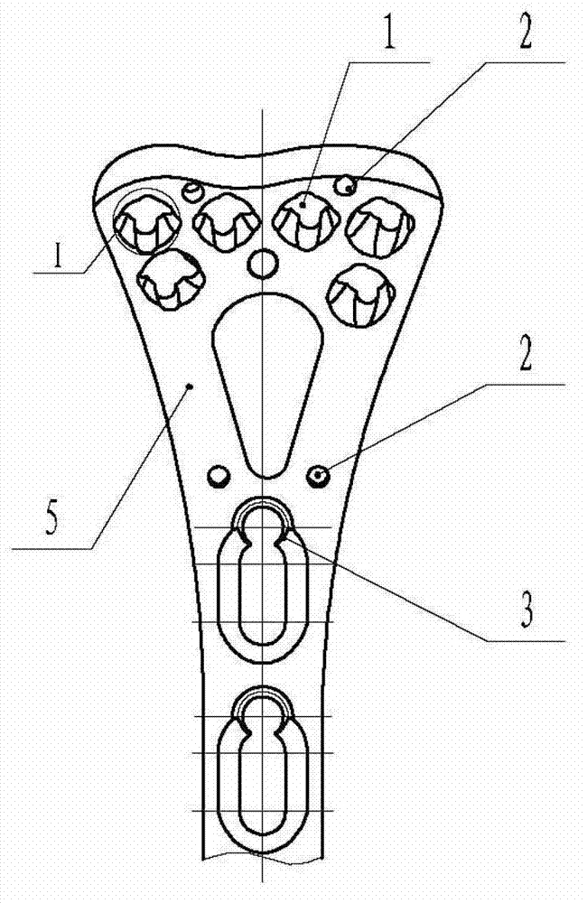 Universal locking and pressurizing bone plate