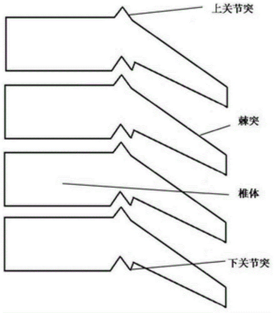 Cervical vertebrae fracture dislocation anterior approach resetting inner fixing system