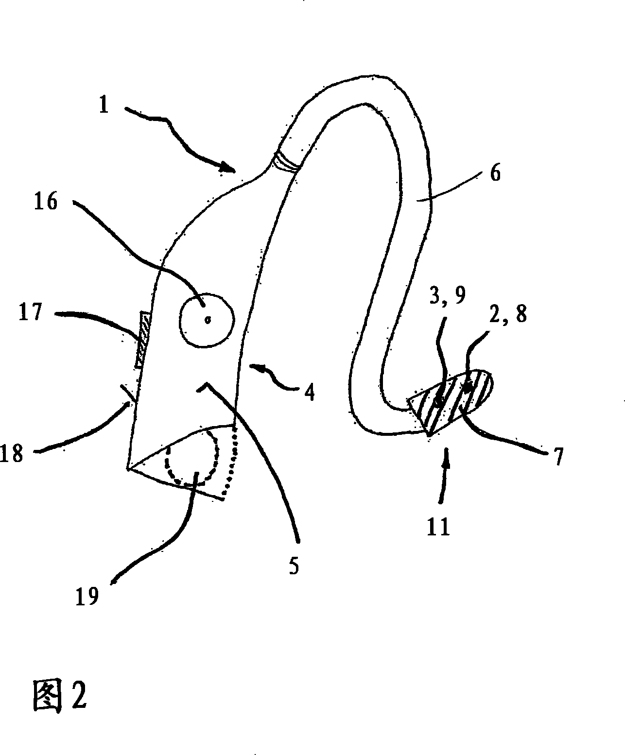 Device for the transdermal stimulation of a nerve of the human body