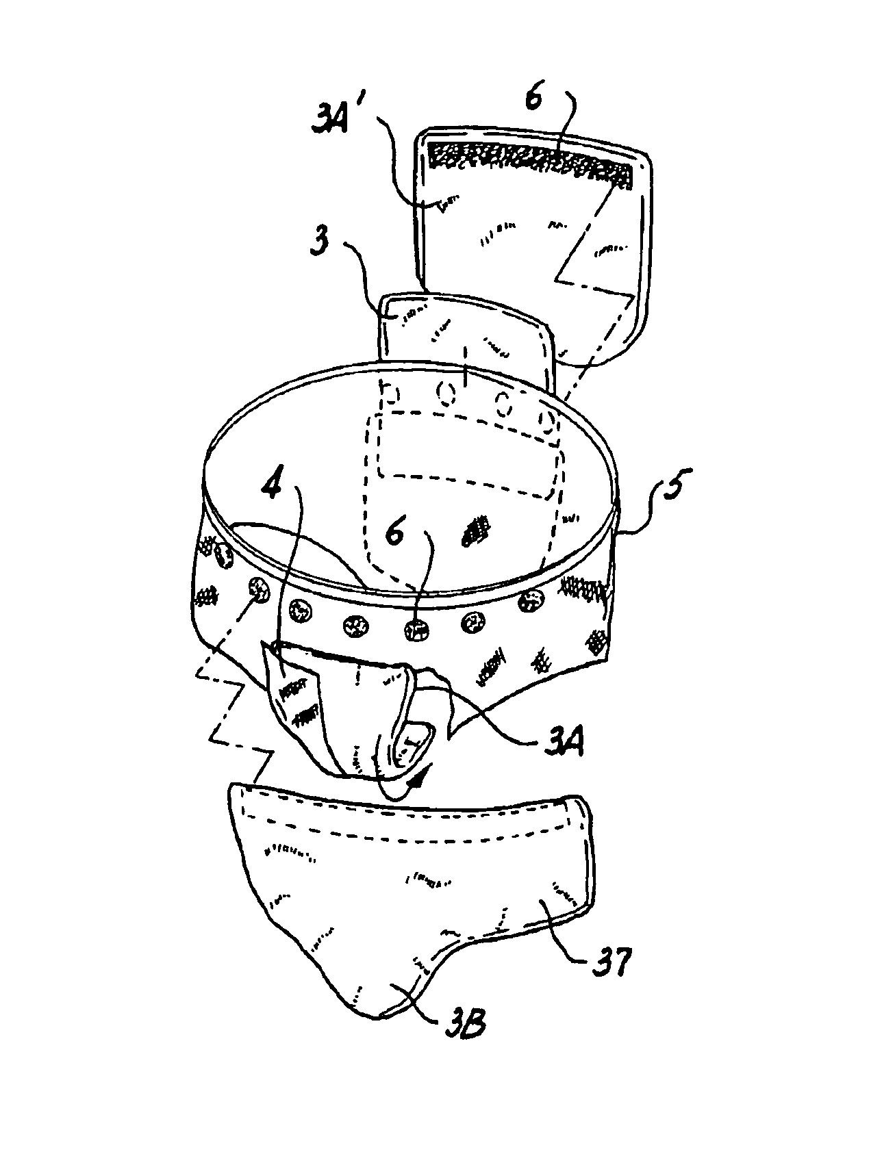 Short use system and method for adaptive radiation protection