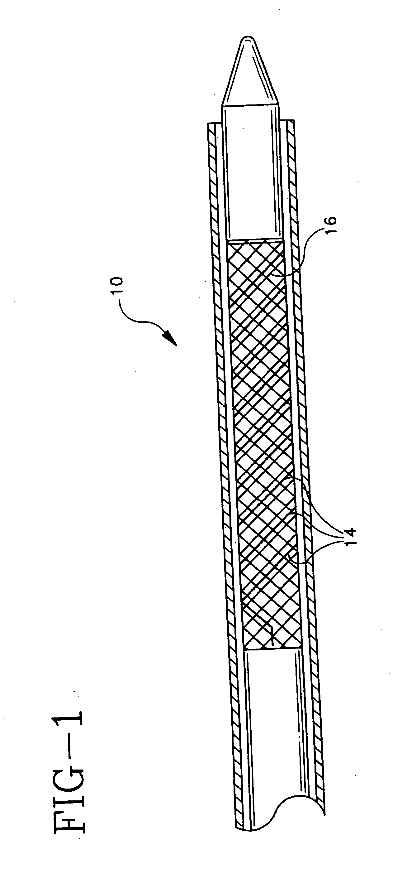 Bioabsorbable marker having radiopaque constituents and method of using the same