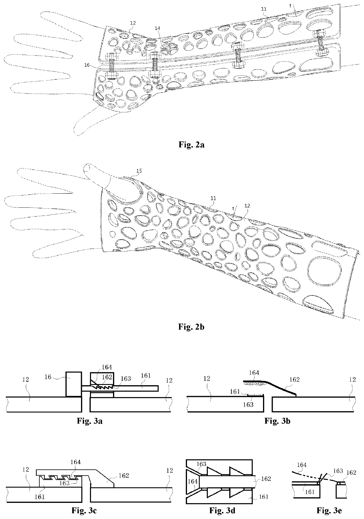 Easily formed arm external fixing brace