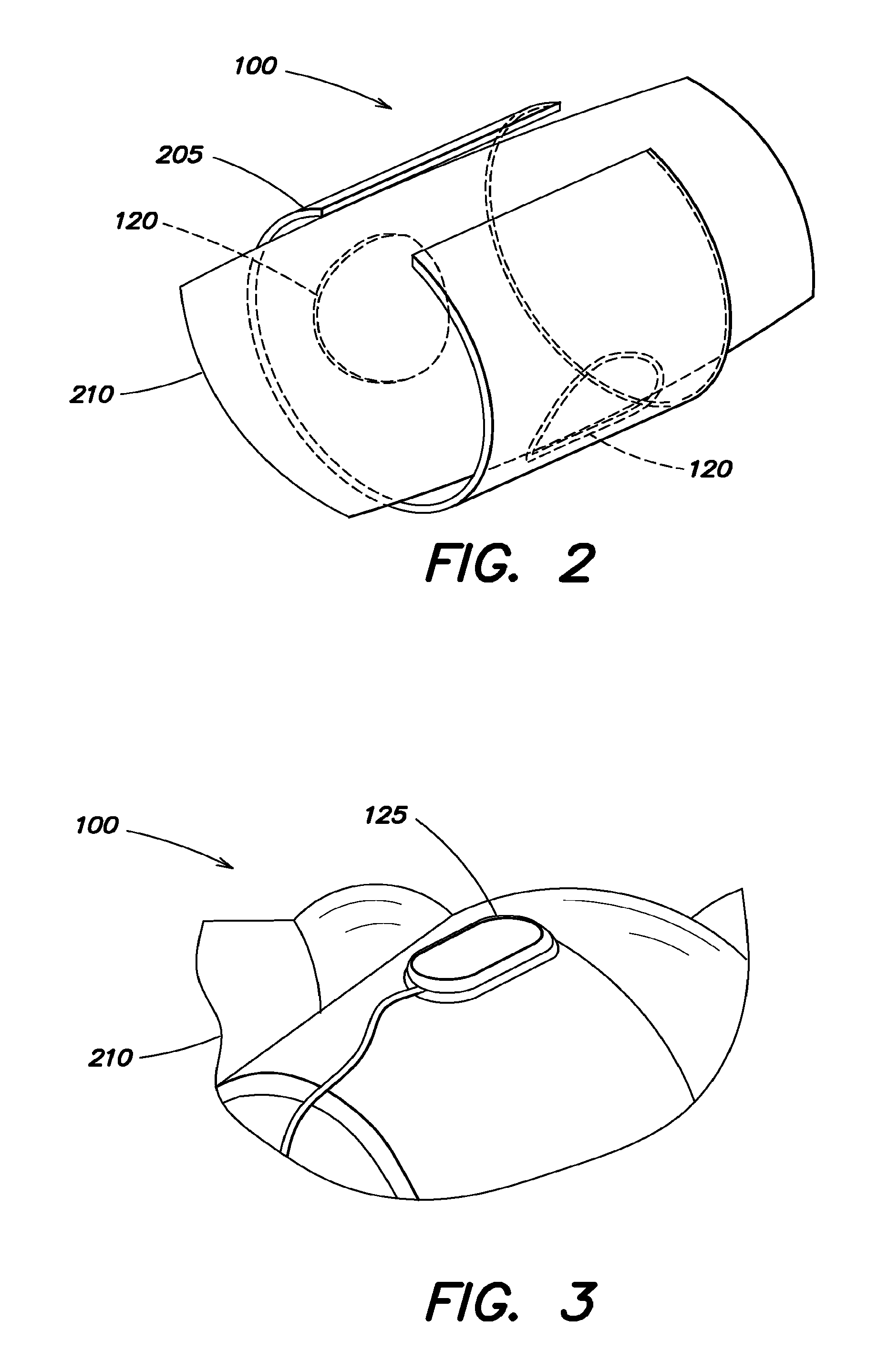 Systems and methods for enhanced venous return flow during cardiac event