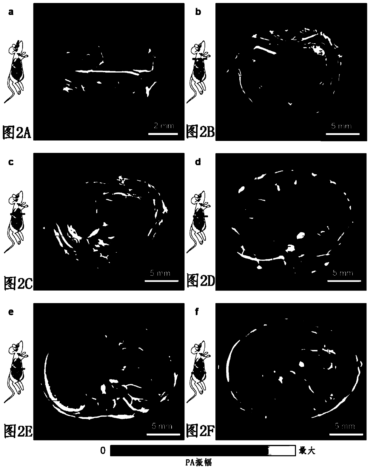 Single-impulse panoramic photoacoustic computed tomography (sip-pact)