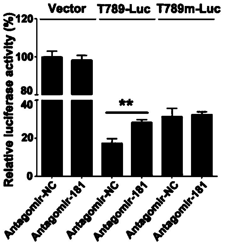 Application of miR181s in preparing drug for treating acute enteritis